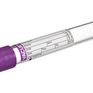 EDTA Blut (K3-EDTA)