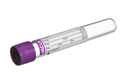 EDTA Blut (K3-EDTA)